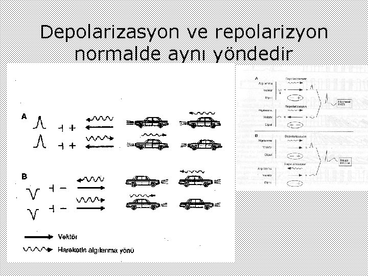 Depolarizasyon ve repolarizyon normalde aynı yöndedir 