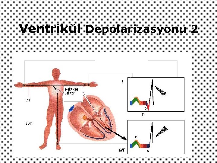 Ventrikül Depolarizasyonu 2 