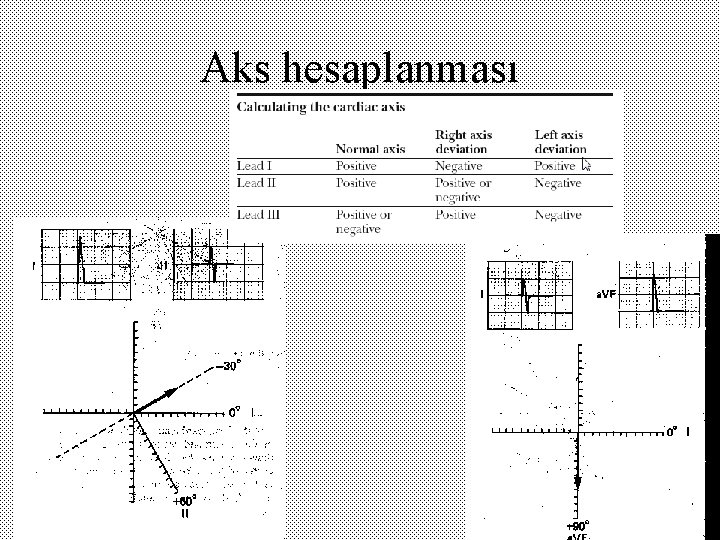 Aks hesaplanması 