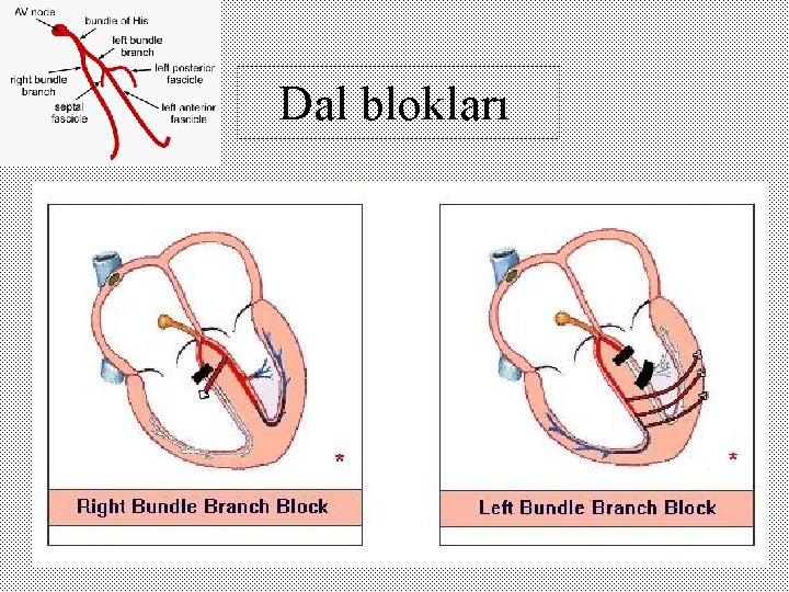 Dal blokları 