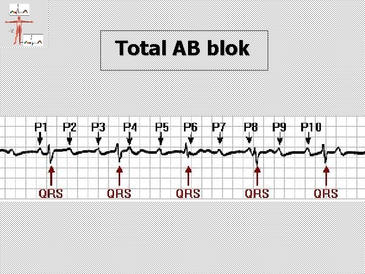 Total AB blok 