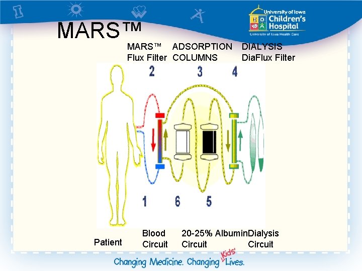 Molecular Adsorbent Recirculating System Patrick Brophy MD Director