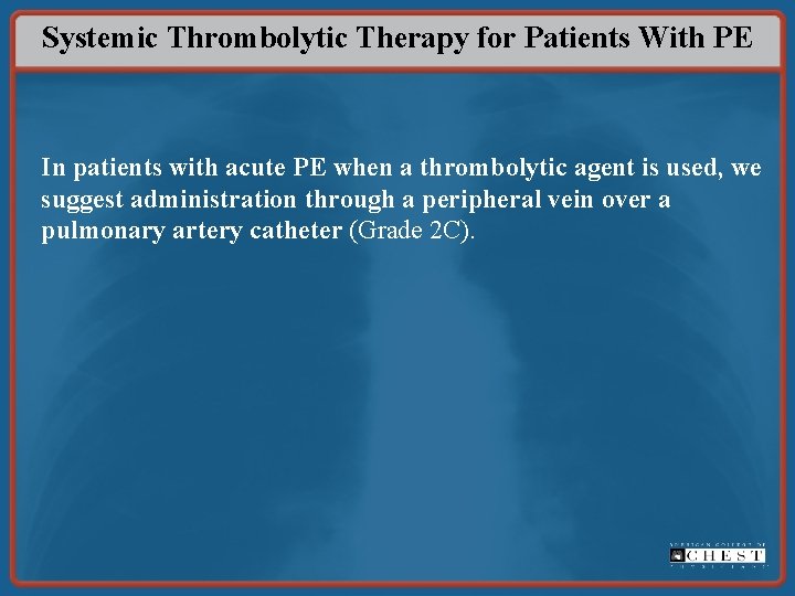 Systemic Thrombolytic Therapy for Patients With PE In patients with acute PE when a