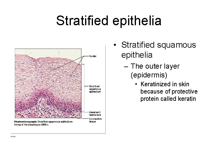 Stratified epithelia • Stratified squamous epithelia – The outer layer (epidermis) • Keratinized in