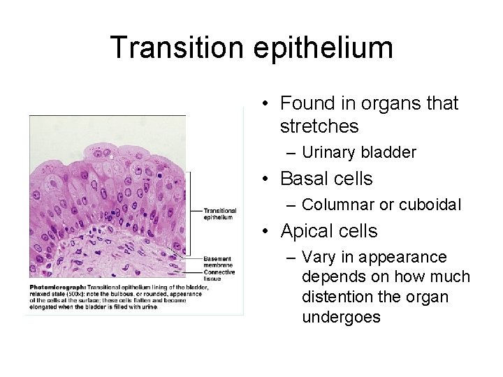 Transition epithelium • Found in organs that stretches – Urinary bladder • Basal cells