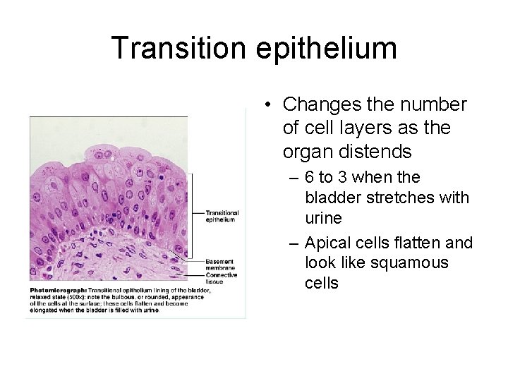 Transition epithelium • Changes the number of cell layers as the organ distends –