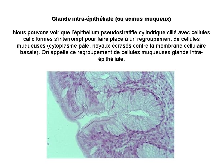 Glande intra-épithéliale (ou acinus muqueux) Nous pouvons voir que l’épithélium pseudostratifié cylindrique cilié avec