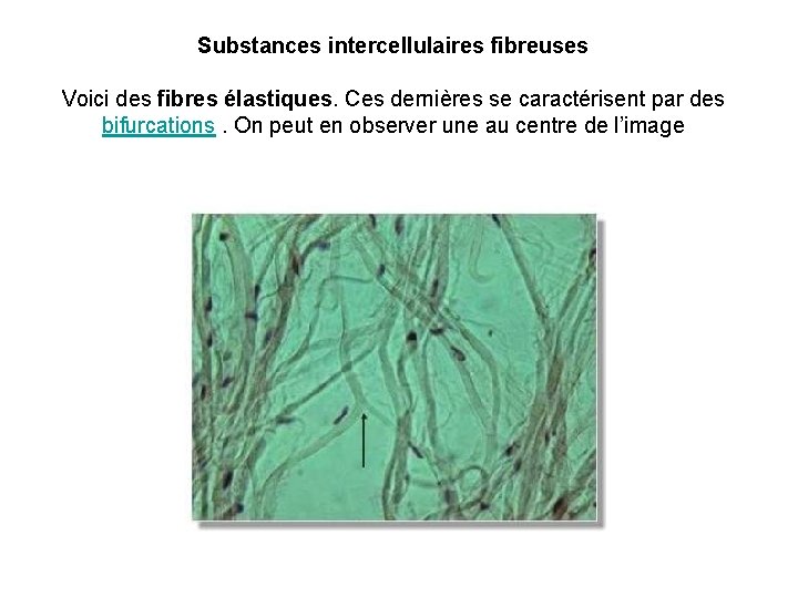 Substances intercellulaires fibreuses Voici des fibres élastiques. Ces dernières se caractérisent par des bifurcations.