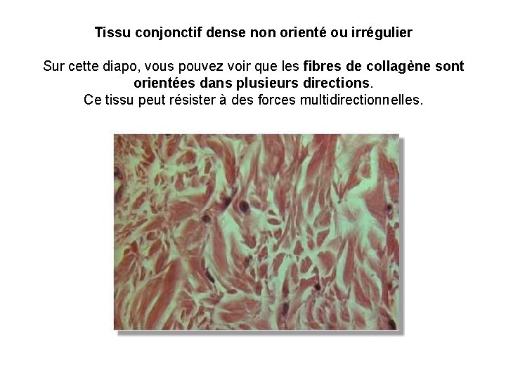 Tissu conjonctif dense non orienté ou irrégulier Sur cette diapo, vous pouvez voir que