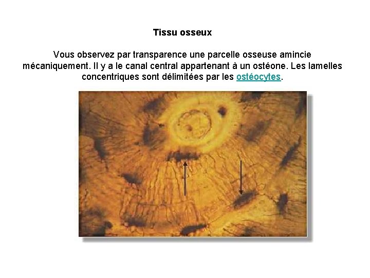 Tissu osseux Vous observez par transparence une parcelle osseuse amincie mécaniquement. Il y a