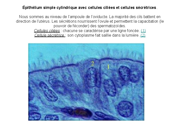 Épithélium simple cylindrique avec cellules ciliées et cellules sécrétrices. Nous sommes au niveau de