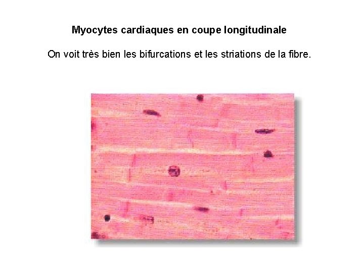 Myocytes cardiaques en coupe longitudinale On voit très bien les bifurcations et les striations