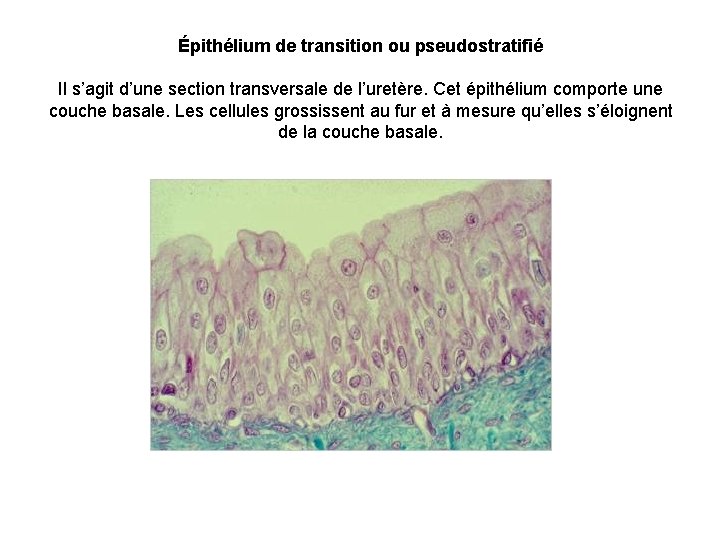 Épithélium de transition ou pseudostratifié Il s’agit d’une section transversale de l’uretère. Cet épithélium