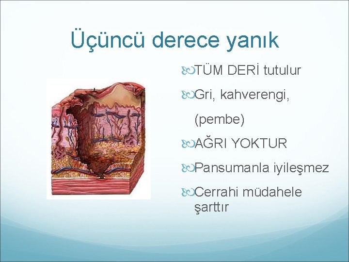 Üçüncü derece yanık TÜM DERİ tutulur Gri, kahverengi, (pembe) AĞRI YOKTUR Pansumanla iyileşmez Cerrahi