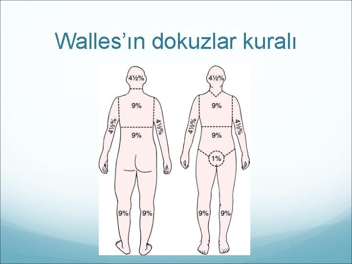 Walles’ın dokuzlar kuralı 