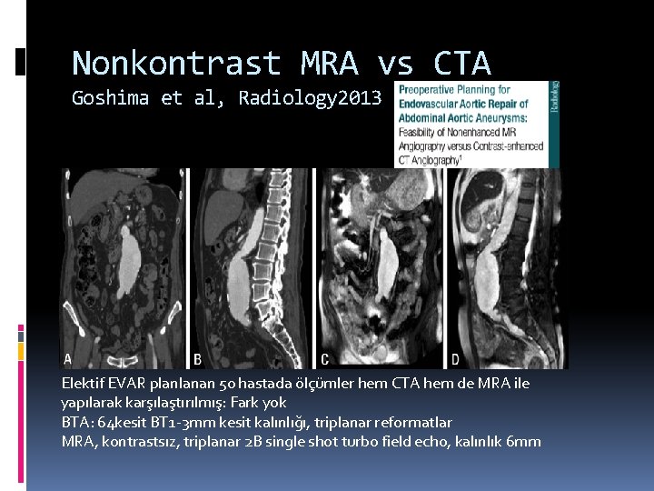 Nonkontrast MRA vs CTA Goshima et al, Radiology 2013 Elektif EVAR planlanan 50 hastada
