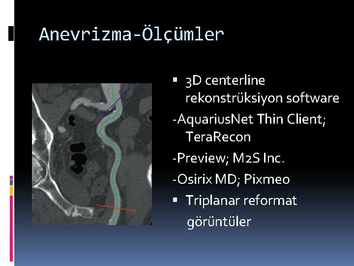 Anevrizma-Ölçümler 3 D centerline rekonstrüksiyon software -Aquarius. Net Thin Client; Tera. Recon -Preview; M