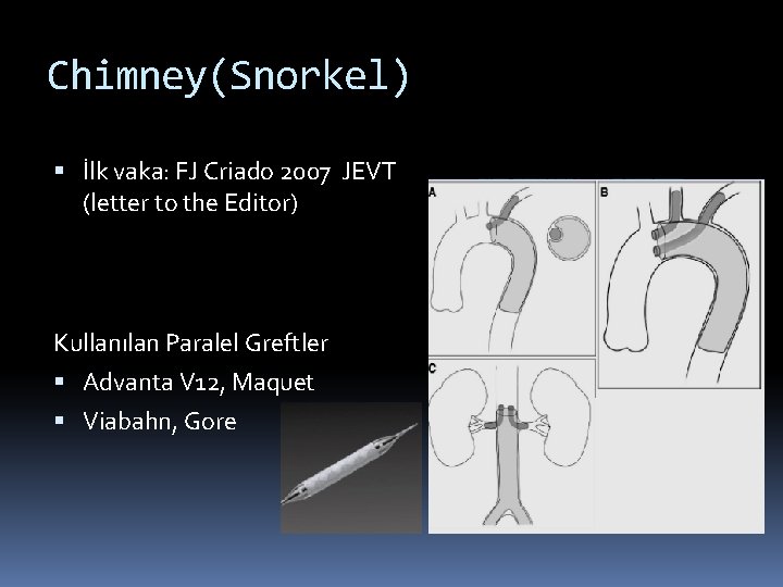 Chimney(Snorkel) İlk vaka: FJ Criado 2007 JEVT (letter to the Editor) Kullanılan Paralel Greftler