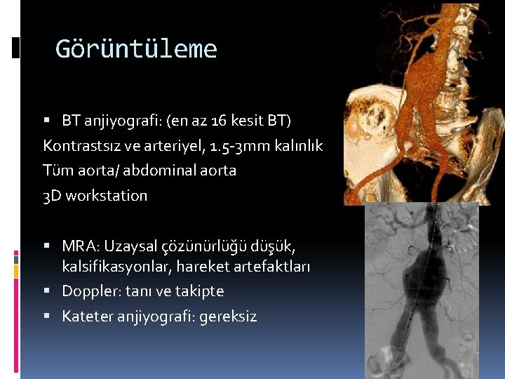 Görüntüleme BT anjiyografi: (en az 16 kesit BT) Kontrastsız ve arteriyel, 1. 5 -3