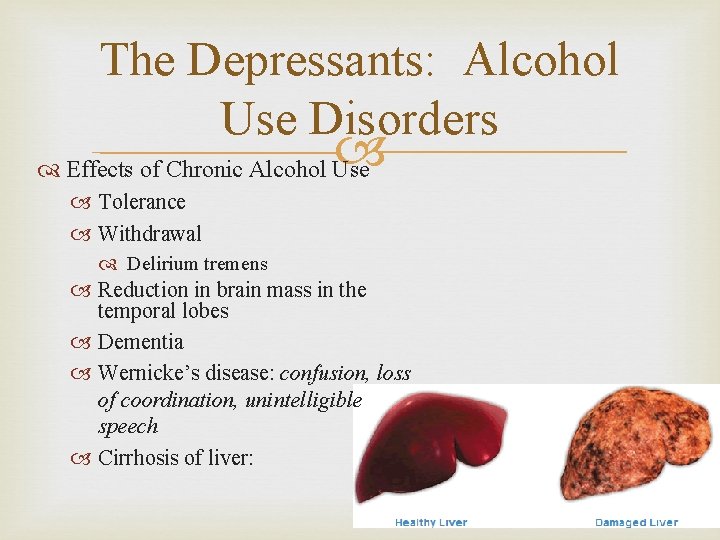 The Depressants: Alcohol Use Disorders Effects of Chronic Alcohol Use Tolerance Withdrawal Delirium tremens