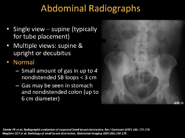 Abdominal Radiographs • Single view – supine (typically for tube placement) • Multiple views: