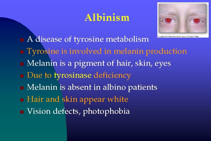 Albinism n n n n A disease of tyrosine metabolism Tyrosine is involved in