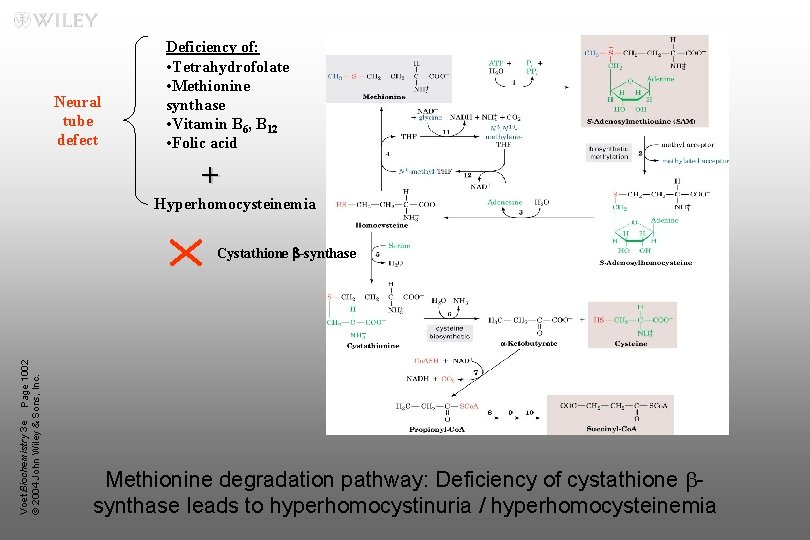 Neural tube defect Deficiency of: • Tetrahydrofolate • Methionine synthase • Vitamin B 6,