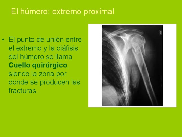 El húmero: extremo proximal • El punto de unión entre el extremo y la