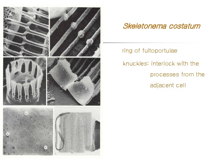 Skeletonema costatum ring of fultoportulae knuckles: interlock with the processes from the adjacent cell