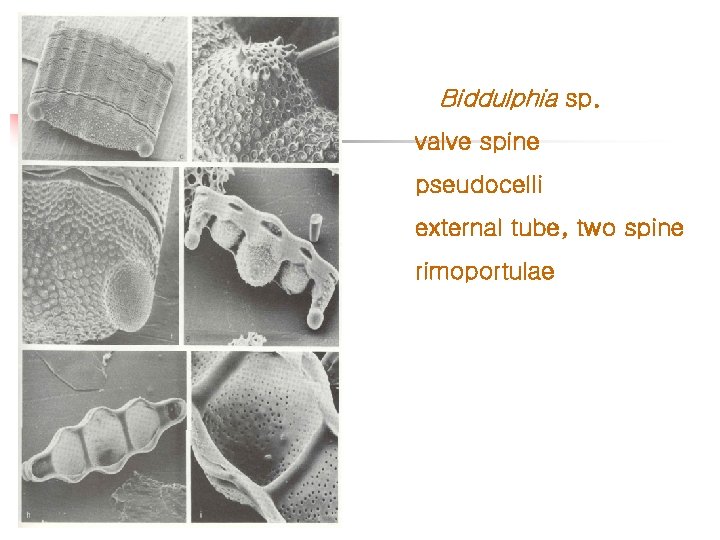 Biddulphia sp. valve spine pseudocelli external tube, two spine rimoportulae 