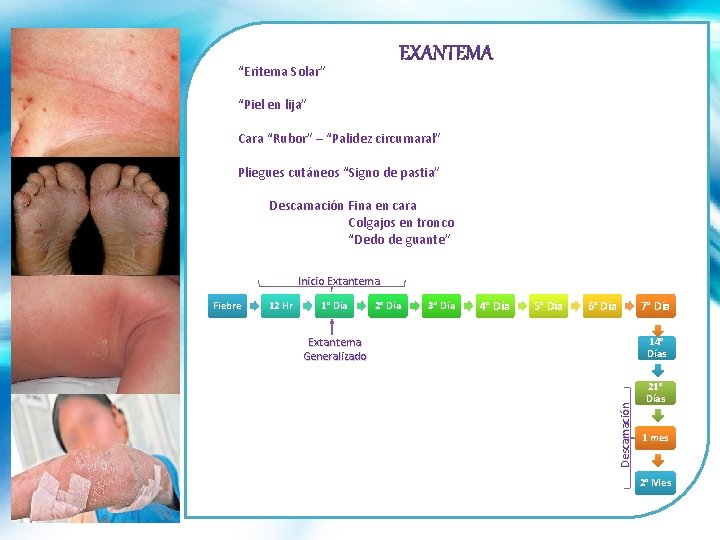 “Eritema Solar” “Piel en lija” Cara “Rubor” – “Palidez circumaral” Pliegues cutáneos “Signo de