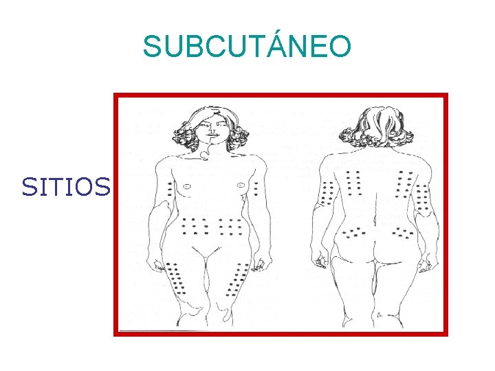 SUBCUTÁNEO SITIOS 