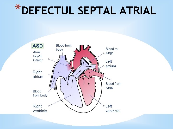 *DEFECTUL SEPTAL ATRIAL 