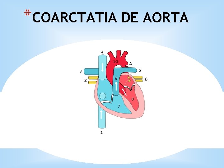 *COARCTATIA DE AORTA 