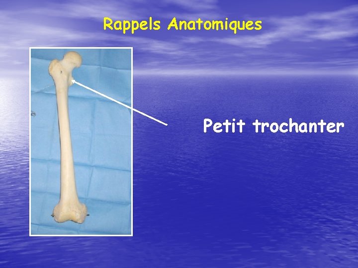 Rappels Anatomiques Petit trochanter 