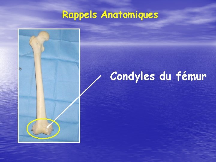 Rappels Anatomiques Condyles du fémur 