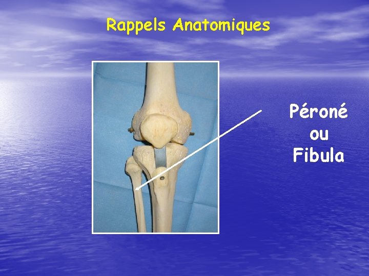 Rappels Anatomiques Péroné ou Fibula 