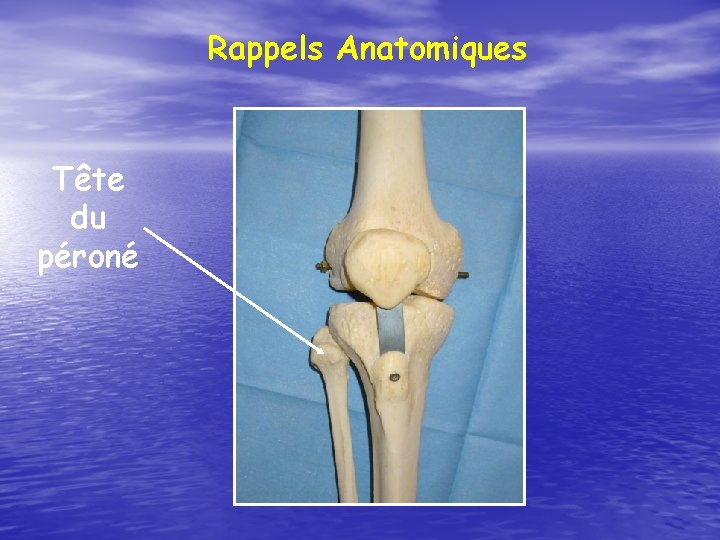 Rappels Anatomiques Tête du péroné 