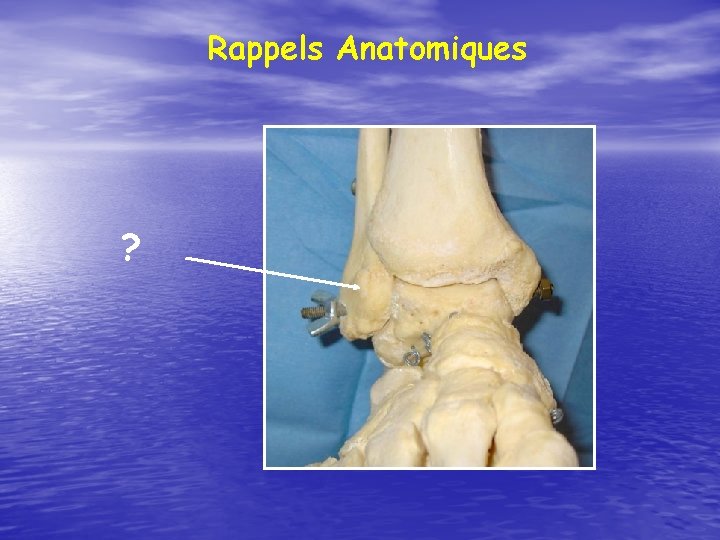 Rappels Anatomiques ? 