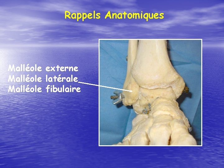 Rappels Anatomiques Malléole externe Malléole latérale Malléole fibulaire 
