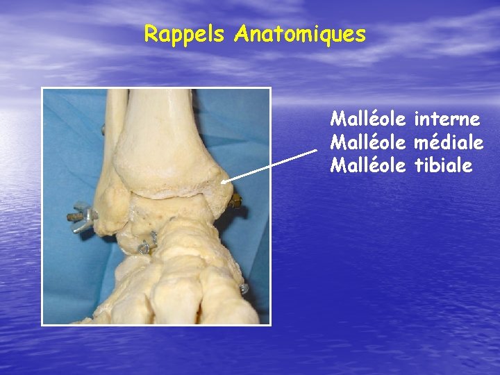 Rappels Anatomiques Malléole interne Malléole médiale Malléole tibiale 