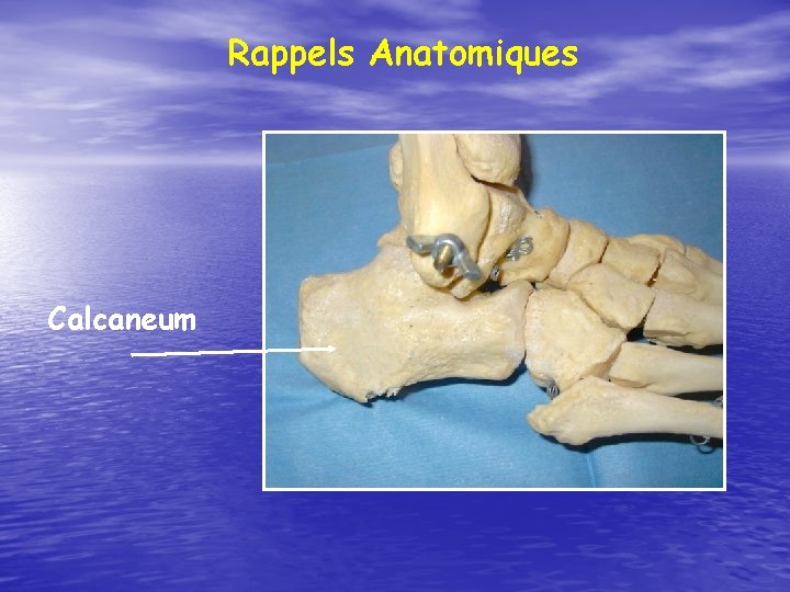 Rappels Anatomiques Calcaneum 
