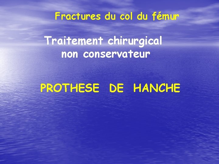 Fractures du col du fémur Traitement chirurgical non conservateur PROTHESE DE HANCHE 