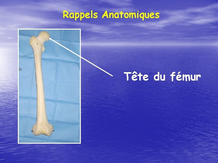 Rappels Anatomiques Tête du fémur 