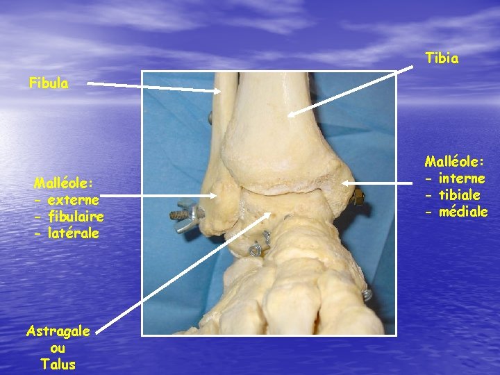 Tibia Fibula Malléole: - externe - fibulaire - latérale Astragale ou Talus Malléole: -