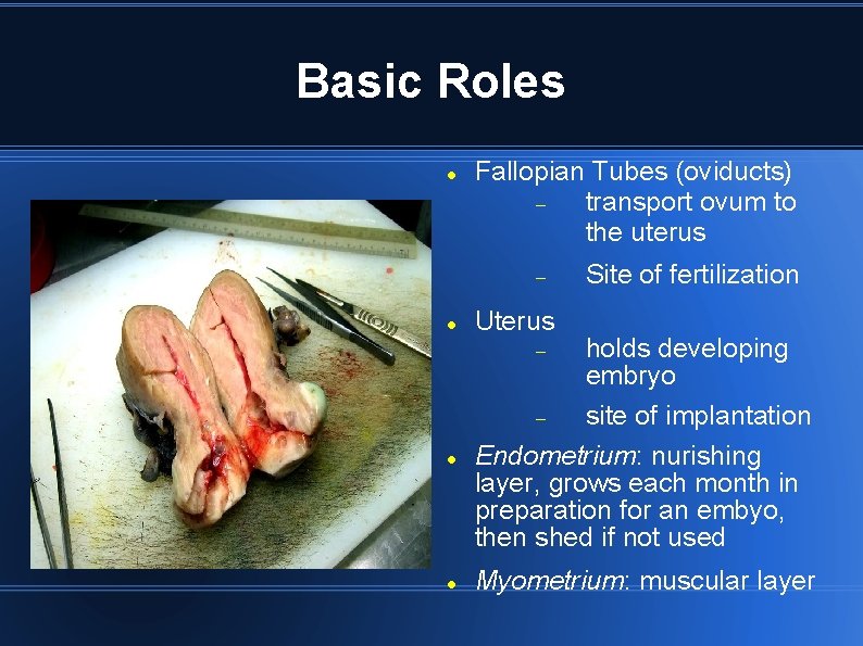 Basic Roles Fallopian Tubes (oviducts) transport ovum to the uterus Site of fertilization Uterus