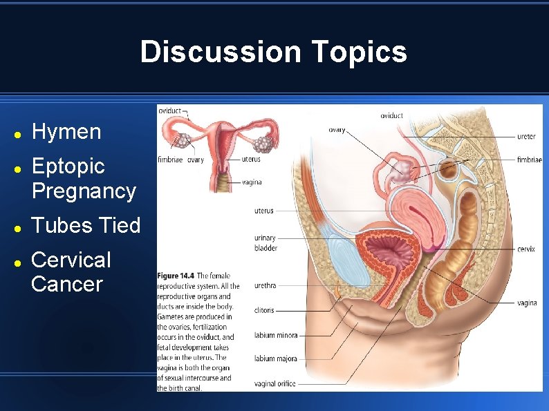 Discussion Topics Hymen Eptopic Pregnancy Tubes Tied Cervical Cancer 