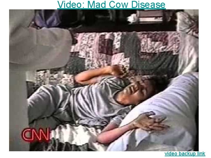 Video: Mad Cow Disease video backup link 
