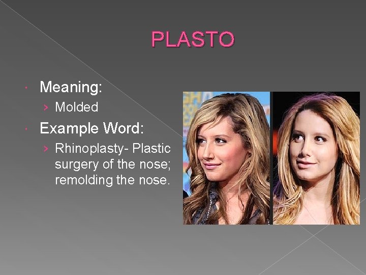 PLASTO Meaning: › Molded Example Word: › Rhinoplasty- Plastic surgery of the nose; remolding
