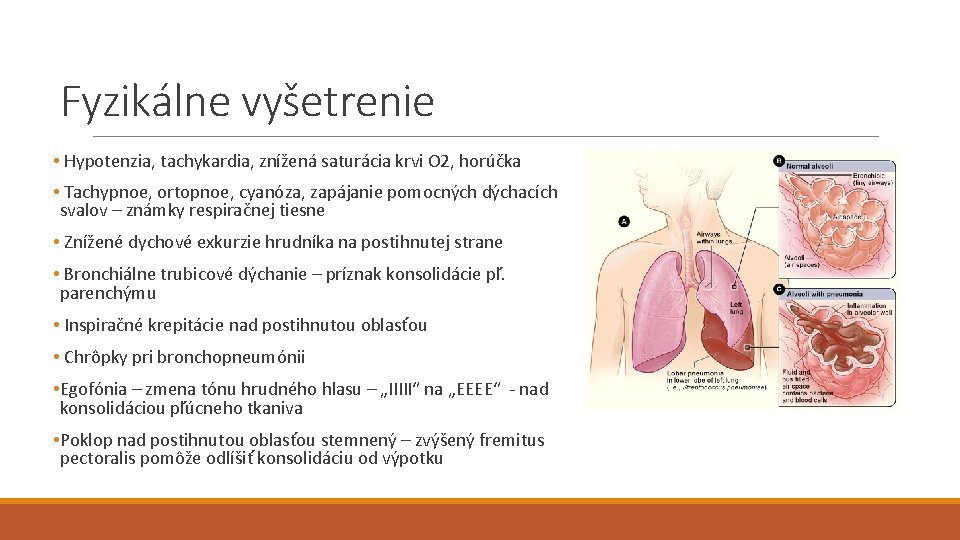 Fyzikálne vyšetrenie • Hypotenzia, tachykardia, znížená saturácia krvi O 2, horúčka • Tachypnoe, ortopnoe,